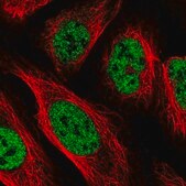 Anti-PPP4R2 antibody produced in rabbit Prestige Antibodies&#174; Powered by Atlas Antibodies, affinity isolated antibody, buffered aqueous glycerol solution
