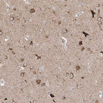 Anti-RPP40 antibody produced in rabbit Prestige Antibodies&#174; Powered by Atlas Antibodies, affinity isolated antibody, buffered aqueous glycerol solution