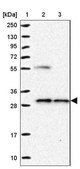 Anti-NUBP2 antibody produced in rabbit Prestige Antibodies&#174; Powered by Atlas Antibodies, affinity isolated antibody, buffered aqueous glycerol solution