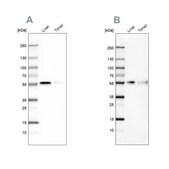 Anti-CD14 antibody produced in rabbit Ab3, Prestige Antibodies&#174; Powered by Atlas Antibodies, affinity isolated antibody, buffered aqueous glycerol solution