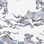 Anti-LPCAT1 antibody produced in rabbit Prestige Antibodies&#174; Powered by Atlas Antibodies, affinity isolated antibody, buffered aqueous glycerol solution, Ab1