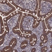 Anti-APC antibody produced in rabbit Prestige Antibodies&#174; Powered by Atlas Antibodies, affinity isolated antibody, buffered aqueous glycerol solution