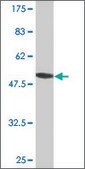 Monoclonal Anti-RPS5 antibody produced in mouse clone 3A5, purified immunoglobulin, buffered aqueous solution