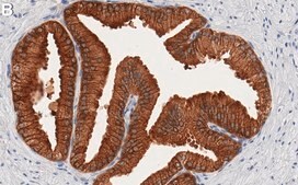 Anti-UGDH Antibody, clone 1F18 ZooMAb® Rabbit Monoclonal recombinant, expressed in HEK 293 cells