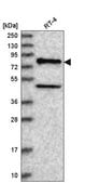 Anti-NADSYN1 antibody produced in rabbit Prestige Antibodies&#174; Powered by Atlas Antibodies, affinity isolated antibody