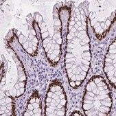 Monoclonal Anti-SATB2 antibody produced in mouse Prestige Antibodies® Powered by Atlas Antibodies, clone CL0320, purified immunoglobulin, buffered aqueous glycerol solution