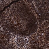 Anti-RNASEH2B antibody produced in rabbit Prestige Antibodies® Powered by Atlas Antibodies, affinity isolated antibody, buffered aqueous glycerol solution