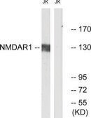 抗-NMDAR1 兔抗 affinity isolated antibody
