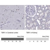 Anti-TBR1 Prestige Antibodies® Powered by Atlas Antibodies