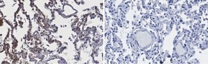 Anti-ACE2-extracellular Antibody, clone 1F21 ZooMAb® Rabbit Monoclonal recombinant, expressed in HEK 293 cells