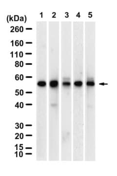 Anti-UGT2B7 Antibody, clone 4C11 ZooMAb&#174; Rabbit Monoclonal recombinant, expressed in HEK 293 cells