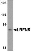 Anti-LRFN5 Antibody from rabbit, purified by affinity chromatography