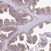 Anti-CLTA antibody produced in rabbit Prestige Antibodies&#174; Powered by Atlas Antibodies, affinity isolated antibody, buffered aqueous glycerol solution
