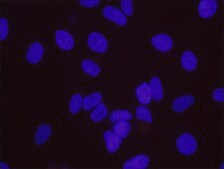 BCR and c-Abl PLA® Antibody Kit Powered by Bethyl Laboratories, Inc.