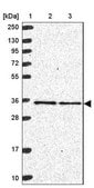 Anti-MRPL4 antibody produced in rabbit Prestige Antibodies&#174; Powered by Atlas Antibodies, affinity isolated antibody, buffered aqueous glycerol solution