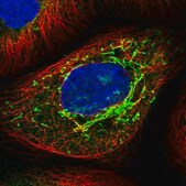 Anti-TTC21B antibody produced in rabbit Prestige Antibodies&#174; Powered by Atlas Antibodies, affinity isolated antibody, buffered aqueous glycerol solution
