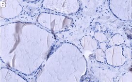 Anti-JNK1 Antibody, clone 1C18 ZooMAb® Rabbit Monoclonal recombinant, expressed in HEK 293 cells