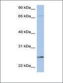 Anti-KLK6 antibody produced in rabbit affinity isolated antibody