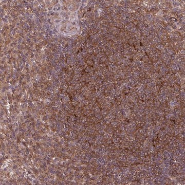Anti-SH3BGRL antibody produced in rabbit Prestige Antibodies&#174; Powered by Atlas Antibodies, affinity isolated antibody, buffered aqueous glycerol solution