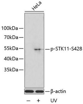 Anti-Phospho-STK11-S428 antibody produced in rabbit