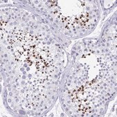 Anti-SPACA1 antibody produced in rabbit Prestige Antibodies&#174; Powered by Atlas Antibodies, affinity isolated antibody, buffered aqueous glycerol solution