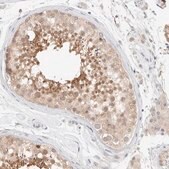 Anti-CHKA antibody produced in rabbit Prestige Antibodies&#174; Powered by Atlas Antibodies, affinity isolated antibody, buffered aqueous glycerol solution