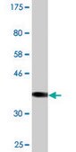 Monoclonal Anti-SULT2B1, (N-terminal) antibody produced in mouse clone 2E5, purified immunoglobulin, buffered aqueous solution