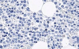 Anti-CD11b Antibody, clone 2G13 ZooMAb&#174; Rabbit Monoclonal recombinant, expressed in HEK 293 cells