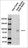 抗SCNN1B 兔抗 1&#160;mg/mL, affinity isolated antibody