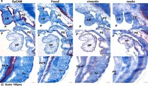 Anti-Nestin antibody produced in rabbit ~1 mg/mL, affinity isolated antibody, buffered aqueous solution