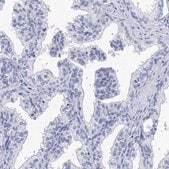 Anti-SPATA7 antibody produced in rabbit Prestige Antibodies&#174; Powered by Atlas Antibodies, affinity isolated antibody, buffered aqueous glycerol solution