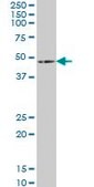 Monoclonal Anti-HOXA5 antibody produced in mouse clone 3B9, purified immunoglobulin, buffered aqueous solution