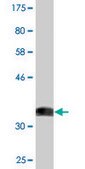 Monoclonal Anti-ACVR1 antibody produced in mouse clone 2D5, purified immunoglobulin, buffered aqueous solution
