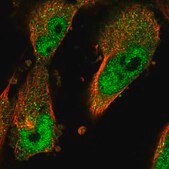 Anti-PGM3 antibody produced in rabbit Prestige Antibodies&#174; Powered by Atlas Antibodies, affinity isolated antibody, buffered aqueous glycerol solution, ab2