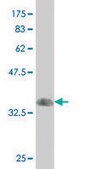 Monoclonal Anti-RXRG antibody produced in mouse clone 6H1, purified immunoglobulin, buffered aqueous solution