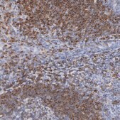 Anti-CD180 antibody produced in rabbit Prestige Antibodies&#174; Powered by Atlas Antibodies, affinity isolated antibody, buffered aqueous glycerol solution