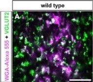 Anti-Vesicular Glutamate Transporter 2 Antibody clone 8G9.2, Chemicon®, from mouse