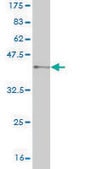 Monoclonal Anti-VRK1 antibody produced in mouse clone 4F9, purified immunoglobulin, buffered aqueous solution