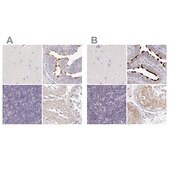 Anti-NME9 antibody produced in rabbit Prestige Antibodies&#174; Powered by Atlas Antibodies, affinity isolated antibody, buffered aqueous glycerol solution