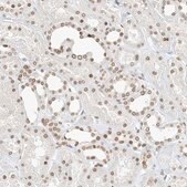 Anti-EIF5A2 antibody produced in rabbit Prestige Antibodies&#174; Powered by Atlas Antibodies, affinity isolated antibody, buffered aqueous glycerol solution
