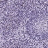 Anti-SLC36A2 antibody produced in rabbit Prestige Antibodies&#174; Powered by Atlas Antibodies, affinity isolated antibody, buffered aqueous glycerol solution