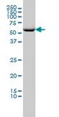 Monoclonal Anti-CCT2 antibody produced in mouse clone 2G6, purified immunoglobulin, buffered aqueous solution