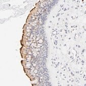 Anti-CYP4B1 antibody produced in rabbit Prestige Antibodies&#174; Powered by Atlas Antibodies, affinity isolated antibody, buffered aqueous glycerol solution