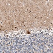 Anti-ZNF703 antibody produced in rabbit Prestige Antibodies&#174; Powered by Atlas Antibodies, affinity isolated antibody, buffered aqueous glycerol solution