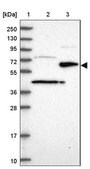 Anti-ST7 antibody produced in rabbit Prestige Antibodies&#174; Powered by Atlas Antibodies, affinity isolated antibody, buffered aqueous glycerol solution