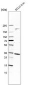Anti-SIRT5 antibody produced in rabbit Prestige Antibodies&#174; Powered by Atlas Antibodies, affinity isolated antibody, buffered aqueous glycerol solution, Ab3