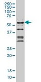 Monoclonal Anti-NFIC antibody produced in mouse clone 1D6, purified immunoglobulin, buffered aqueous solution