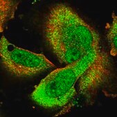 Anti-AHR antibody produced in rabbit Prestige Antibodies&#174; Powered by Atlas Antibodies, affinity isolated antibody, buffered aqueous glycerol solution, ab1