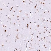 Anti-HNRNPA0 antibody produced in rabbit Prestige Antibodies&#174; Powered by Atlas Antibodies, affinity isolated antibody, buffered aqueous glycerol solution