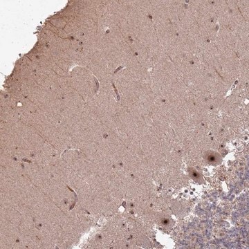 Anti-UTP11 antibody produced in rabbit Prestige Antibodies&#174; Powered by Atlas Antibodies, affinity isolated antibody, buffered aqueous glycerol solution